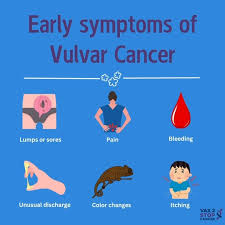 Image result for Vulvar Cancer