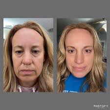 And natures most magical ingredient for all dermatology issues…. 🙏🩷🩷🩷