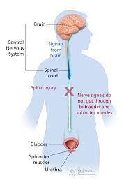 Neurogenic Bladder Symptoms Diagnosis Treatment Urology Care Foundation