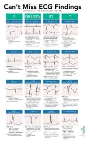 Can T Miss Ecg Findings Cards For The Emergency Medicine Provider Cardiac Nursing Icu Nursing Critical Care Nursing