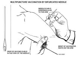 Eventually, smallpox vaccination became mandatory in massachusetts. Https Www Health Mil Reference Center Policies 2003 01 10 Army Spv Implementation Plan