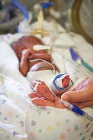 how much weight should a premature baby gain per week