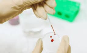 «la enfermedad por el virus de marburgo (emv) es una enfermedad muy virulenta y con tendencia a las. Zrmoissoprm4gm