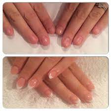 Before And After Nail Biter Acrylic Nails Acrylic Nails Nails Inspiration Nails