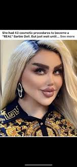 Woman's Appearance Compared to Barbie