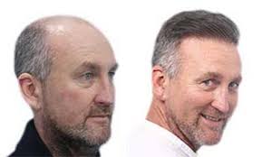 Choose an elite Coalition Physician with proven results