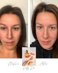 🫶🏼Skincare that gives a sh*t about You! (@alaglowskincare) • Instagram  photos and videos