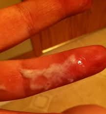 It is a discharge that is clear, watery, sticky and sometimes stretchy. Haven T Had Period Since July 10 Days Late Pic Of Discharge Included Tmi Babycenter