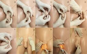 Image result for Cremasteric Reflex