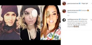 La richiesta degli avvocati difensori di edson tavares, ex fidanzato di gessica notaro, accusato e condannato per stalking e per aver sfigurato con l'acido nel 2017 l'attuale concorrente di ballando con. Gessica Notaro Eta Ex Fidanzato Acido Storia Lavoro Tutto Sull Ex Miss Solonotizie24