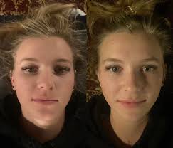 Buccal massage for TMJ and jaw pain relief