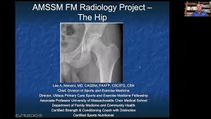 Image result for Hip XRay