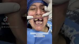 ▷ Biografia: Dr David Flor ✓ Especialista en Implantologia Dental