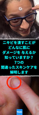 ニキビを潰すことが どんなに肌に ダメージを 与えるか 知っていますか 7つの 間違ったスキンケアを 解明します 正しいスキンケアしてますか 肌荒れの意外な原因 ニキビ 潰す 日焼け止め 正しい洗顔 水分不足 美肌 スキンケア 肌荒れ 原因 ちえとく ニキビ