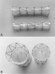 The stent has been designed to maintain patency of stenosed trachea or bronchus due to extrinsic compression caused by a tumor. Use Of The 25 Mm Flanged Esophageal Z Stent For Malignant Dysphagia A Prospective Multicenter Trial Sciencedirect