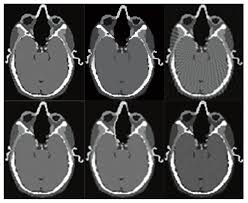* consists of 1 detector with rows of detector elements. Algorithms Free Full Text Image Resolution Enhancement Of Highly Compressively Sensed Ct Pet Signals Html