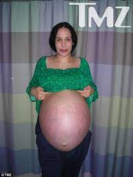Teboho tsotetsi of tembisa township, ekurhuleni, said his wife, gosiame thamara sithole, 37, gave birth to decuplets at a pretoria hospital. Octuplet Mom Nadya Suleman S Pregnancy Photos Sheknows