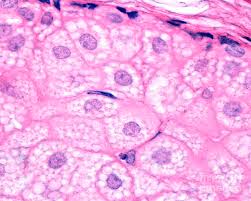 Image result for Sebaceous Gland