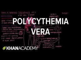 What Is Polycythemia Vera Hematologic System Diseases Nclex Rn Khan Academy Youtube Polycythemia Vera Essential Thrombocythemia Vera