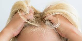 Lice can and do affect all people with hair, freshly bathed or long for a shower, of all races, ages, social classes and genders. How To Get Rid Of Head Lice Best Natural Head Lice Remedies