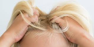 You should however note that hair dye does not kill nits. How To Get Rid Of Head Lice Best Natural Head Lice Remedies