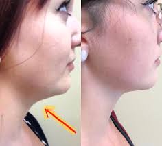 Premier Plastic Surgery