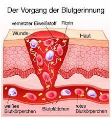 Wundheilung Im Mund Plattchenreiches Plasma Prp