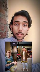 Aleema Ali Before and After