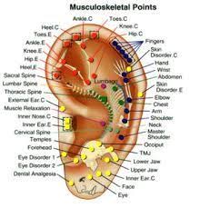 14 best fibropain images in 2017 acupuncture points