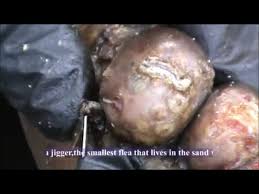 To turn off these warnings you need to set the 'safe mode' to off (on the top right). Jim Nduruchi Nasty Foot Jigger Removal Youtube