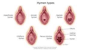 Karena terdorongnya jaringan endometrium ke luar dari kondisi normalnya, maka akan menyebabkan beberapa gangguan mulai dari siklus menstruasi hingga nyeri di bagian perut atau panggul. 15 Upaya Pencegahan Penyakit Pada Sistem Reproduksi Manusia Beserta Gambarnya Materi Kimia