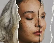 How to become an occupational therapist