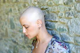 Started shedding day 12 and this is day 13 my email: Washington Taxotere Hair Loss Lawsuit Seattle Spokane