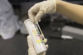 Image result for Urine Output