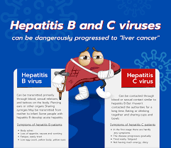 Image result for hepatitis symptoms