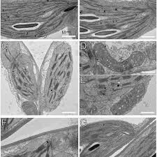 Check spelling or type a new query. Transmission Electron Microscopic Images Of Chloroplasts And Download Scientific Diagram