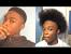 2 Year Hair Growth Black Male