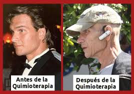El actor Patrick Swayze tras la quimioterapia