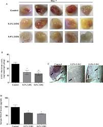 A place for defense grid 2 architect creators to share and showcase their custom maps and get valuable community feedback. Dietary 2 Deoxy D Glucose Impairs Tumour Growth And Metastasis By Inhibiting Angiogenesis Sciencedirect
