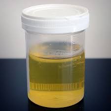 Urine Therapy Wikipedia The Free Encyclopedia Urine Therapy Cloudy Urine Plantar Wart