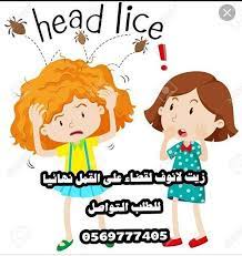 الآن نوفر لكي الحل الوحيد للقضاء على القمل بطريقة فعاله ومضمونه وامنة جدا وايضا يحمي شعر طفلكي من اي عدوى بالمستقبل مجرب من قبل المئات من الامهات اﻷن اقتني