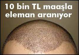 10 Bin Tl Maasla Sac Ekim Elemani Araniyor