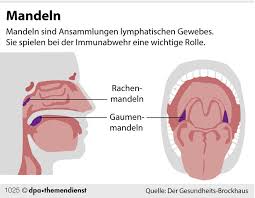 Standige Entzundungen Wann Mussen Die Mandeln Raus Rhein Neckar Zeitung Regionalnachrichten Rnz