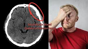 Image result for CT Head