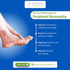 Image result for Peripheral Neuropathy