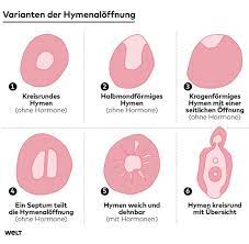Wenn die impfpflicht kommt, ist auswandern auf jeden fall eine option für mich. Mythos Jungfernhautchen Was Ist Das Hymen Welt