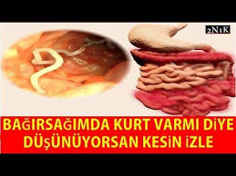 Parazit Tedavi Yontemleri Oneriler Dr Aidin Salih Gercek Tip Kitabi Youtube 2020 Tip Gercekler Saglikli Yasam