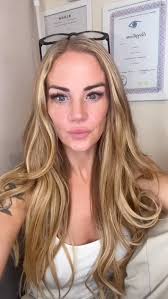 If you feel you are struggling with any questions in the aesthetics world  then I am here to help!, DM me the word HELP and I will add you to a free  what’s app group so I can answer any questions you ...