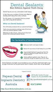 What Is Dental Sealants Top Benefits Of Dental Sealants Dental Dentalimplants Dentistry Dentistry For Kids Dentistry Dental Sealants