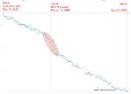 Daily Weight Loss Progress Before And After Bariatric